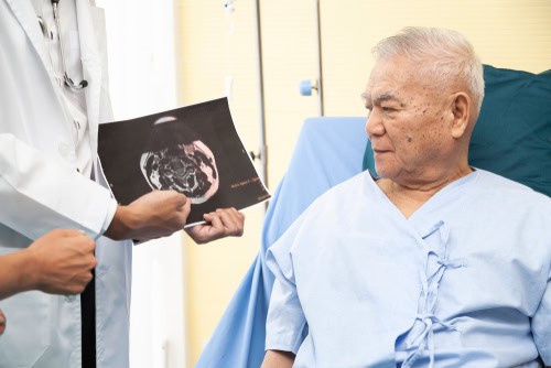 Understanding Dementia